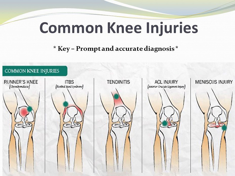 Trauma To Knee Joint